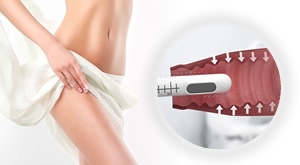 [ZAGREB] Vodite borbu s inkontinencijom? Izaberite 1 ili 3 VAGINALNA HIFU tretmana u ordinaciji dr. Šeba u Zagrebu i zaboravite na suhoću, peckanje ili nelagodu uz do 50% popusta!