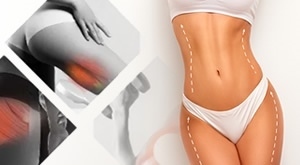 PRVI PUT NA CRNOM JAJU! Bio+klinik ZAGREB - RAZBIJTE celulit i ZATEGNITE kožu u 30 min uz Tesla EMS + RF za samo 19 €!  Najbrži put do SAVRŠENE linije uz VRHUNSKU tehnologiju!