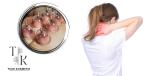 CUPPING MASAŽA u Tuus Kosmetik - napravite detox ili tretirajte bolne mišiće, glavobolje i probleme s kralježnicom