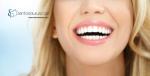Čišćenje zubnog kamenca, poliranje, pjeskarenje i pregled u ordinaciji Dental Plus Miramare