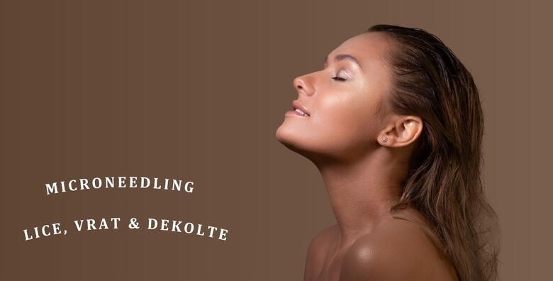 MICRONEEDLING LICA, VRATA I DEKOLTEA - anti-age tretman visokoučinkovite njege u Jean d`Arcel Medical & Beauty Institutu
