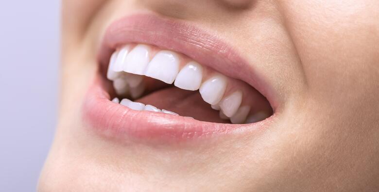Dental studio Marić - čišćenje zubnog kamenca sa pjeskarenjem uz pregled