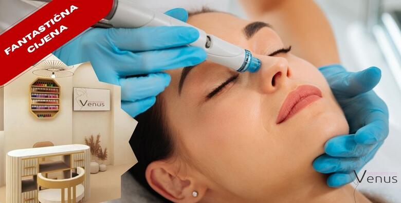 HYDRAFACIAL tretman u Medicinsko estetskom centru Venus by Lucija Šarić u SESVETAMA